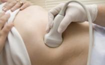 Внематочная беременность: симптомы, причины и лечение От чего бывает внематочная беременность причина